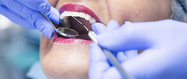 Best Broken or Cracked Tooth Emergency Dentist in Opp, AL